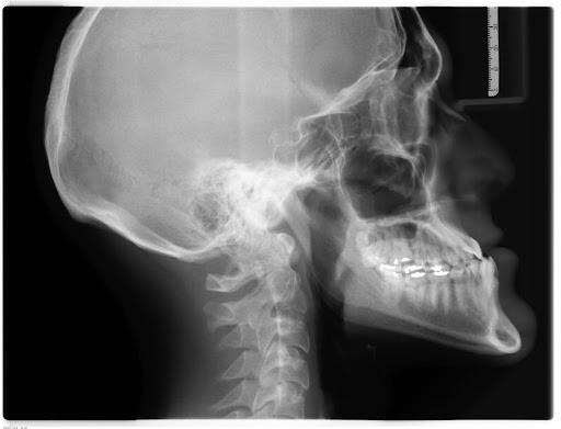 Same-Day Dental X-Rays in Northlake, Charlotte, NC | Next Level